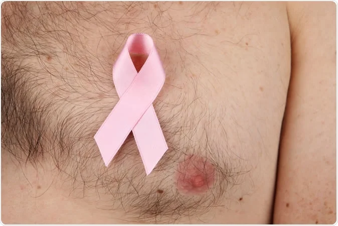 m/سرطان پستان در مردان 