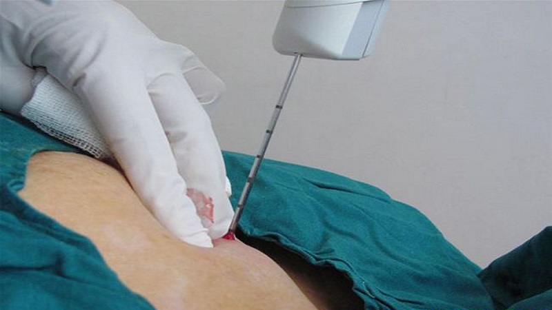 Breast biopsy in Jordan