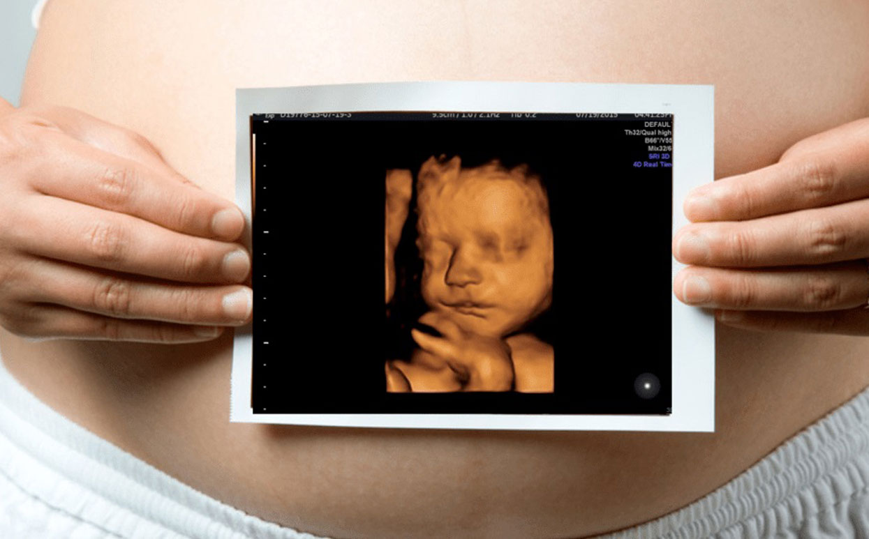 m/سونوگرافی 4 بعدی در تهران