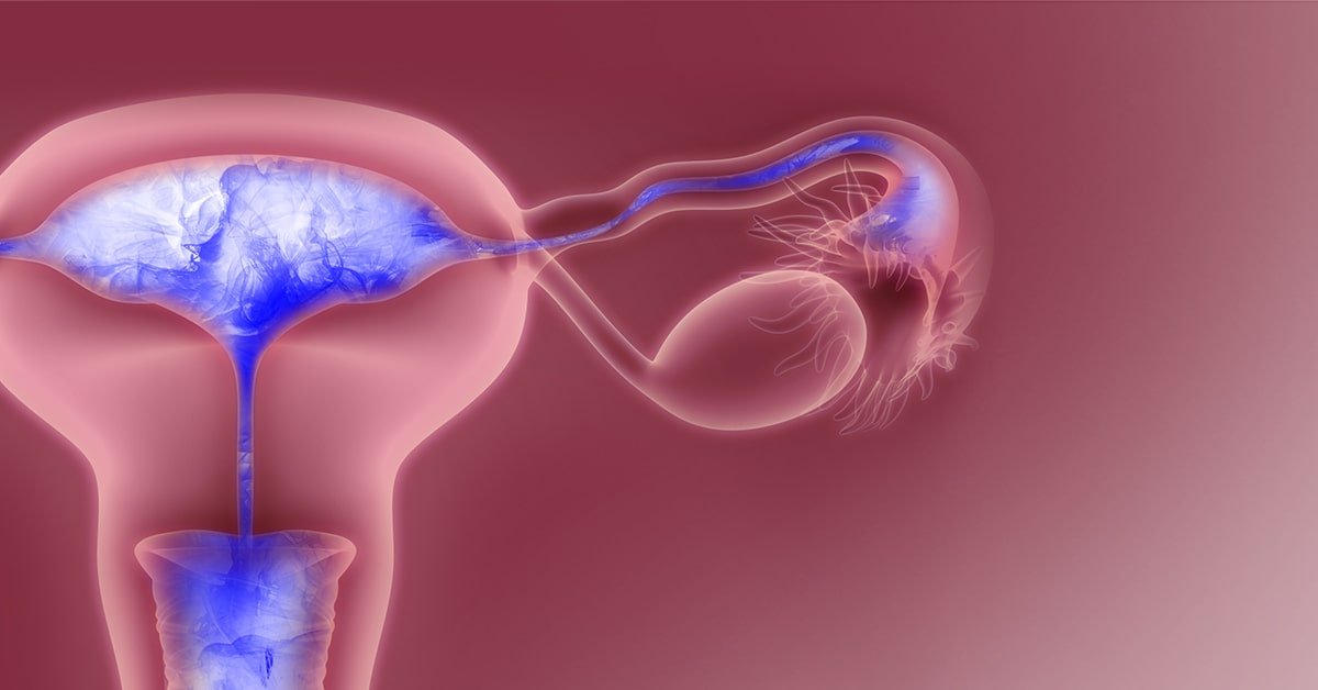 M/عکس رنگی رحم با بی حسی در تهران