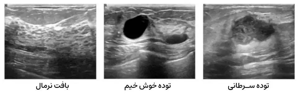 m/مراكز سونوگرافی سينه در تهران