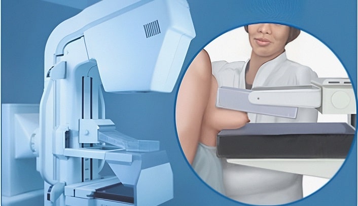 m/مامو گرافی چیست وچگونه انجام میشود؟