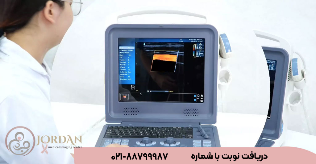 بهترین مرکز سونوگرافی کالر داپلر سینه در تهران
