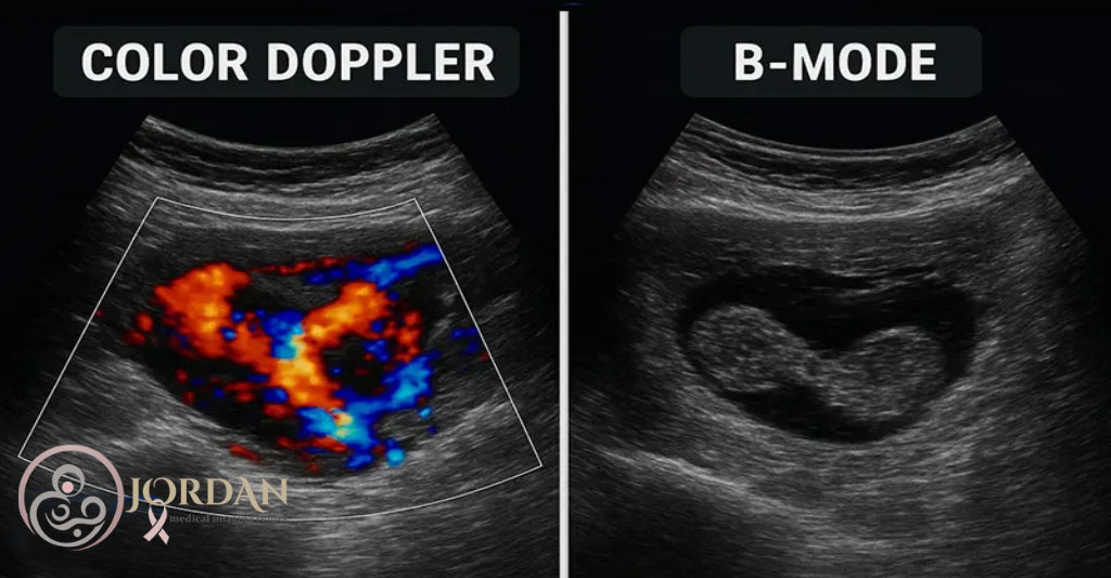 سونوگرافی داپلر و سونوگرافی معمولی