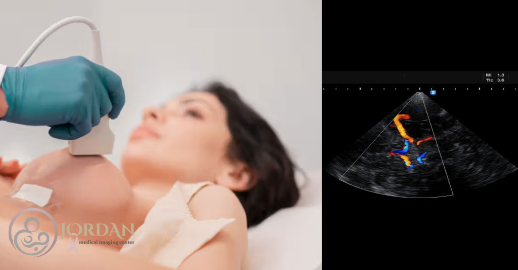 نحوه انجام سونوگرافی کالر داپلر