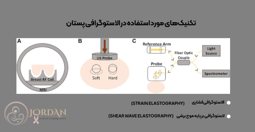 تکنیک‌های  الاستوگرافی پستان