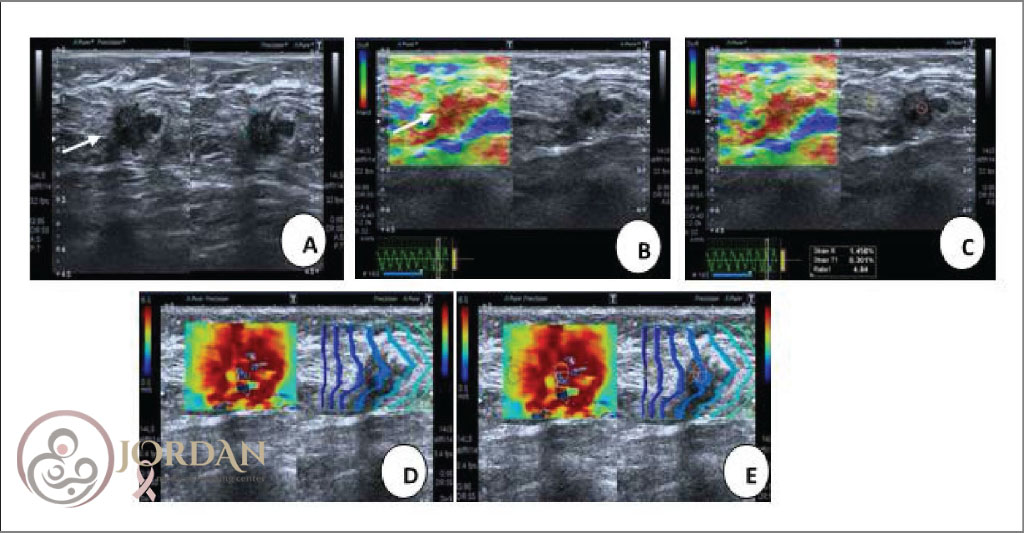 تصاویر تولید شده دستگاه آلاستوگرافی