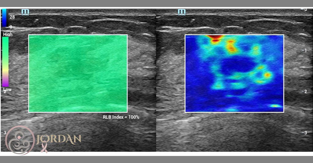نحوه نشان دادن تصاویر در الاستوگرافی