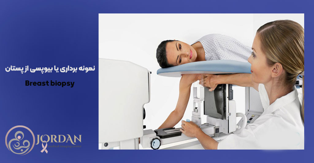بیوپسی پستان