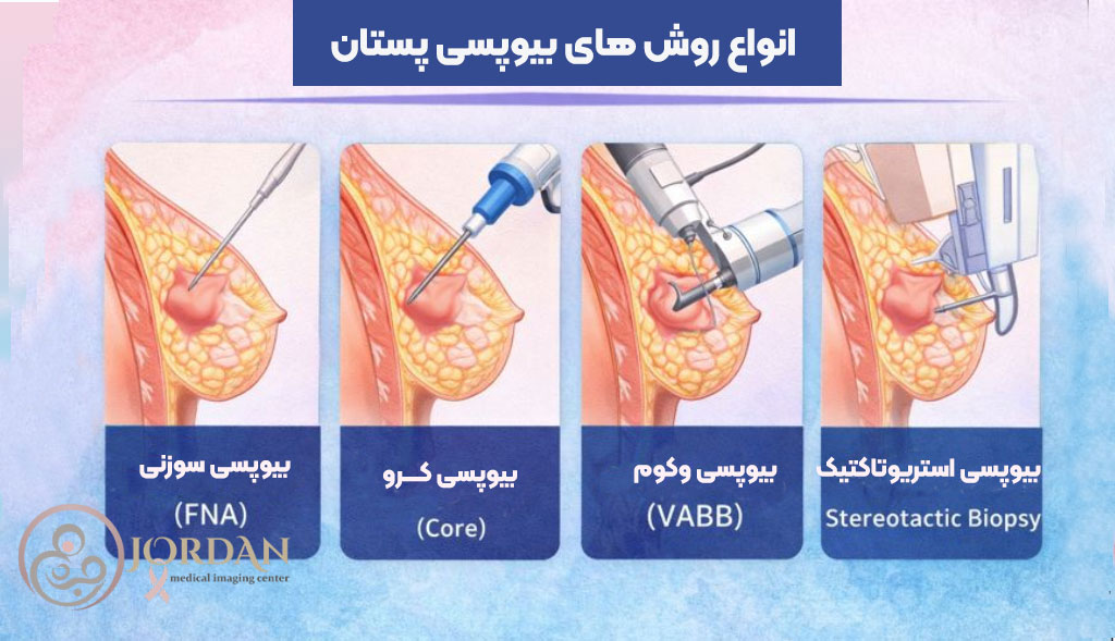 انواع نمونه برداری سینه