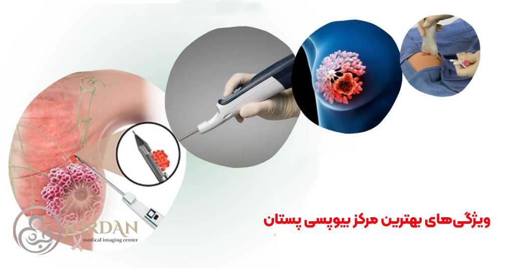 ویژگی‌های بهترین مرکز بیوپسی پستان 