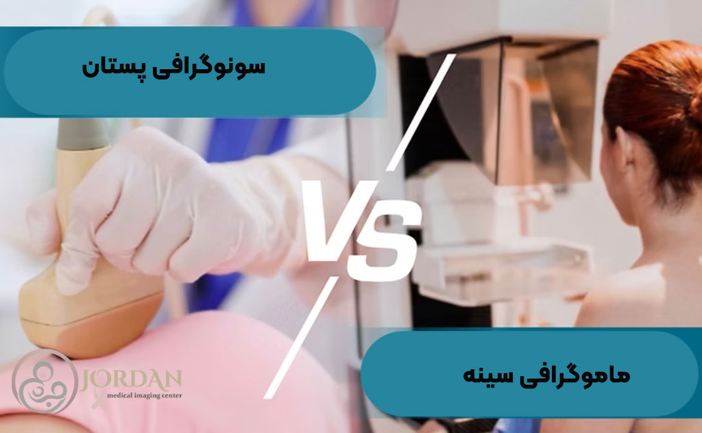 سونوگرافی بعد از ماموگرافی