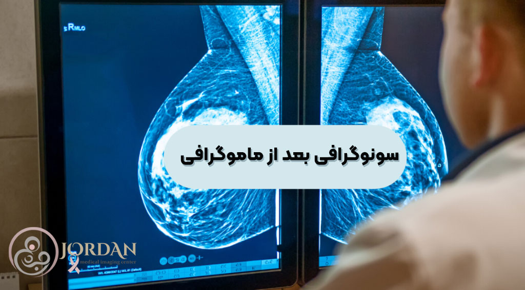 دلایل سونوگرافی بعد از ماموگرافی